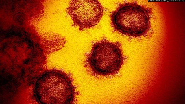 Klaster SARS-CoV-2 (severe acute respiratory syndrome coronavirus 2) atau virus corona yang menyebabkan Covid-19 tampak di mikroskop. (Foto: U.S. National Institute of Allergy and Infectious Diseases)